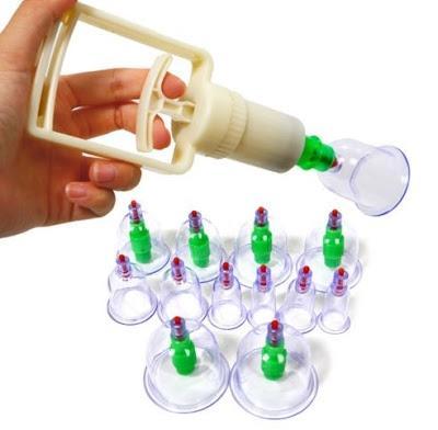 Intareste-ti imunitatea! Set 12 ventuze medicinale terapeutice
