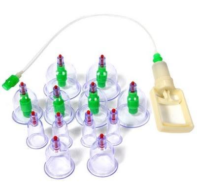Intareste-ti imunitatea! Set 12 ventuze medicinale terapeutice