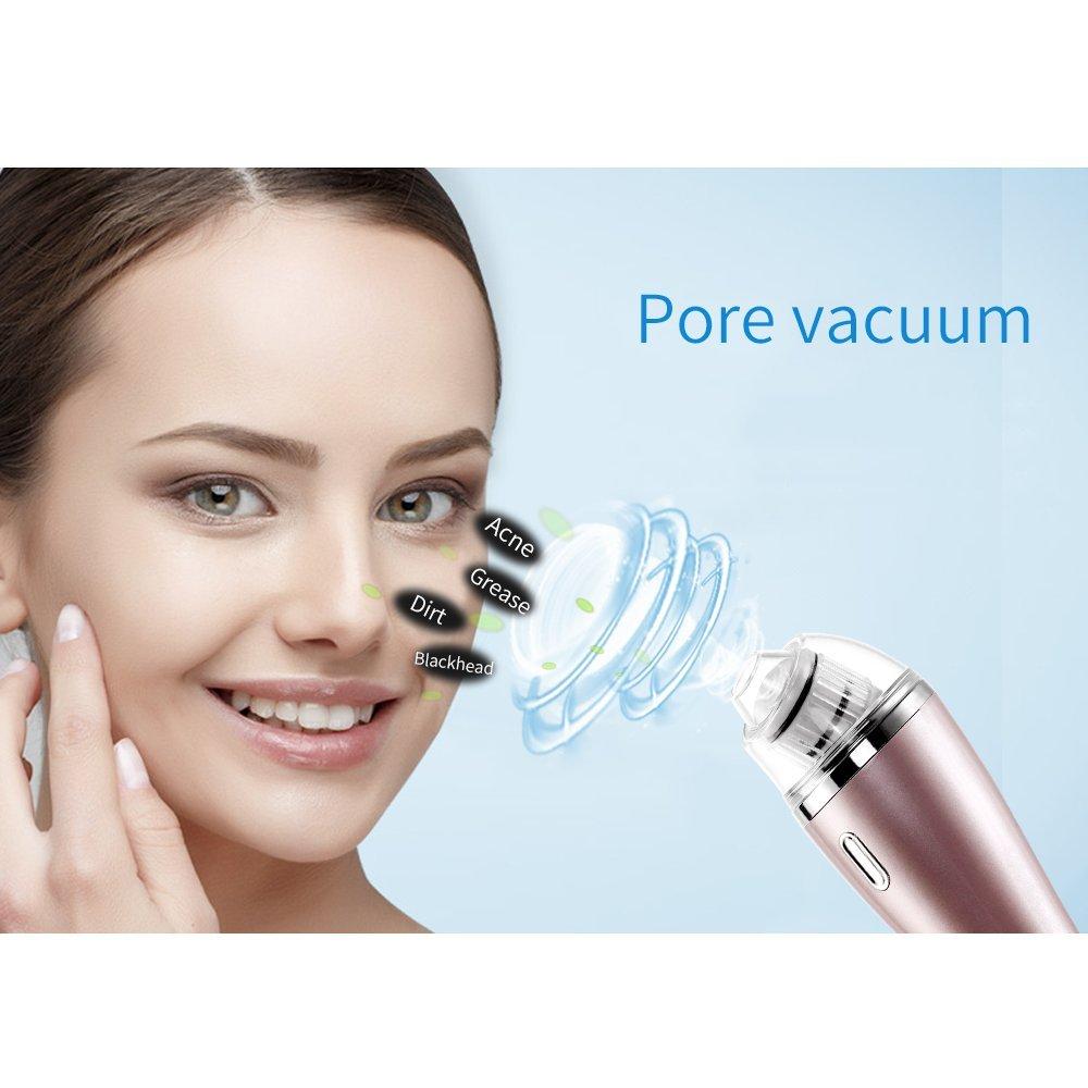Aparat cu vacuum pentru curatarea tenului in profunzime